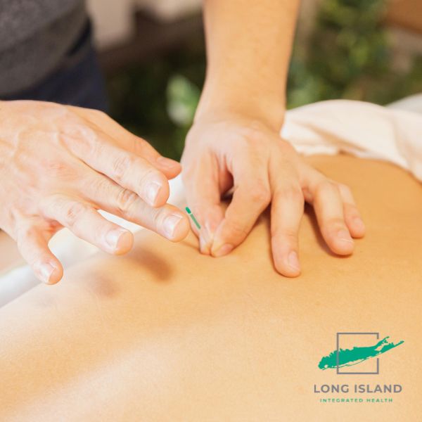 LI Integrated LP (2)